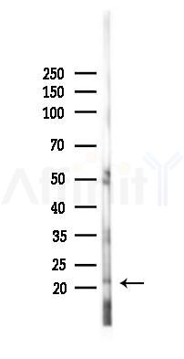 Histone H3 Antibody - Western blot analysis of lysates from PC12 cells(starvation 24h treatment), using Histone H3 Antibody at 1/1000 dilution.