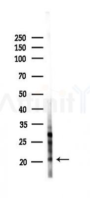 Histone H3 Antibody - Western blot analysis of lysates from EC304 cells(starvation 24h treatment), using Histone H3 Antibody at 1/1000 dilution.
