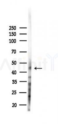 MEF2A Antibody - Western blot analysis of lysates from EC304 cells(starvation 24h treatment), using MEF2A Antibody at 1/1000 dilution.