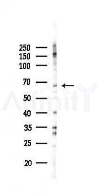 SHP2 Antibody - Western blot analysis of lysates from K562 cells(UV 30min treatment), using SHP2 Antibody at 1/1000 dilution.