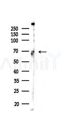BTK Antibody - Western blot analysis of lysates from K562 cells(UV 30min treatment), using BTK Antibody at 1/1000 dilution.