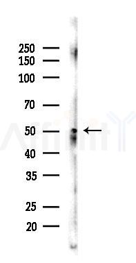 MEF2C Antibody - Western blot analysis of lysates from Mouse lung, using MEF2C Antibody at 1/1000 dilution.