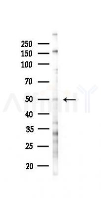 MEF2C Antibody - Western blot analysis of lysates from EC304 cells(starvation 24h treatment), using MEF2C Antibody at 1/1000 dilution.