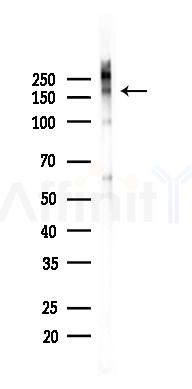 NMDAR2B Antibody - Western blot analysis of lysates from Mouse lung, using NMDAR2B Antibody at 1/1000 dilution.