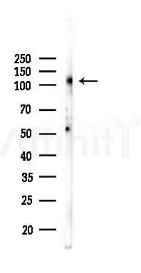 GAB1 Antibody - Western blot analysis of lysates from K562 cells(UV 30min treatment), using GAB1 Antibody at 1/1000 dilution.