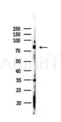 GAB1 Antibody - Western blot analysis of lysates from K562 cells(UV 30min treatment), using GAB1 Antibody at 1/1000 dilution.
