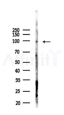 Nrf2 Antibody - Western blot analysis of lysates from PC12 cells(LPS 4h treatment), using Nrf2 Antibody at 1/1000 dilution.