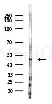 RIP3 Antibody - Western blot analysis of lysates from 293 cells(LPS 4h treatment), using RIP3/RIPK3 Antibody at 1/1000 dilution.