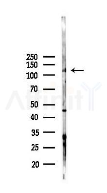 Phospho-CBL (Tyr731) Antibody - Western blot analysis of lysates from HUVEC cells(starvation 24h treatment), using Phospho-CBL (Tyr731) Antibody at 1/1000 dilution.