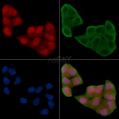 Phospho-AMPK beta 1 (Ser181) Antibody - AF8030 staining Hela cells(24h of starvation treatment) by IF/ICC.