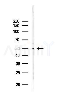 Phospho-TGFBR1 (Ser165) Antibody - Western blot analysis of lysates from Mouse testis, using Phospho-TGFBR1 (Ser165) Antibody at 1/1000 dilution.