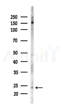 Phospho-VHL (Ser68) Antibody - Western blot analysis of lysates from RAW264.