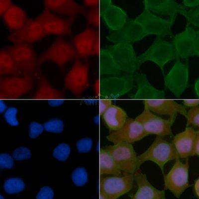 Phospho-Cyclin E1 (Ser399) Antibody - AF8341 staining Hela cells(24h of starvation treatment) by IF/ICC.