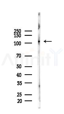 Phospho-FAK (Ser722) Antibody - Western blot analysis of lysates from A2780 cells(LPS 4h treatment), using Phospho-FAK (Ser722) Antibody at 1/1000 dilution.