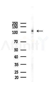 Phospho-FAK (Ser722) Antibody - Western blot analysis of lysates from Mouse lung, using Phospho-FAK (Ser722) Antibody at 1/1000 dilution.