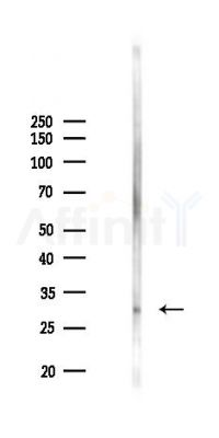 Phospho-HtrA2 (Ser142) Antibody - Western blot analysis of lysates from Rat brain, using Phospho-HtrA2 (Ser142) Antibody at 1/1000 dilution.