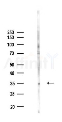 Phospho-ketohexokinase (Ser80) Antibody-Isoform A - Western blot analysis of lysates from Rat brain, using Phospho-ketohexokinase (Ser80) Antibody-Isoform A at 1/1000 dilution.