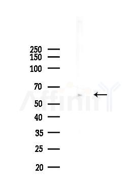 Cables2 Antibody - Western blot analysis of lysates from Mouse liver, using Cables2 Antibody at 1/1000 dilution.