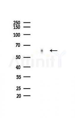 Cables2 Antibody - Western blot analysis of lysates from Mouse brain, using Cables2 Antibody at 1/1000 dilution.