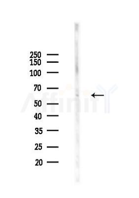Cables2 Antibody - Western blot analysis of lysates from Hela cells(starvation 24h treatment), using Cables2 Antibody at 1/1000 dilution.