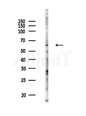 Cables2 Antibody - Western blot analysis of lysates from K562 cells(UV 30min treatment), using Cables2 Antibody at 1/1000 dilution.