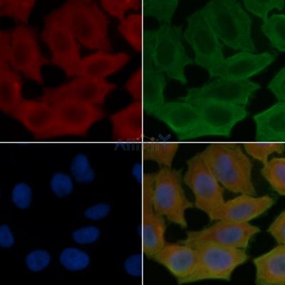 CMTM4 Antibody - AF9042 staining Hela cells(24h of starvation treatment) by IF/ICC.