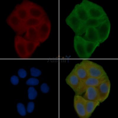 DHHC-9 Antibody - AF9054 staining Hela cells(24h of starvation treatment) by IF/ICC.