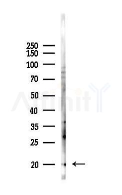 HEN1/2 Antibody - Western blot analysis of lysates from PC12 cells(LPS 4h treatment), using HEN1/2 Antibody at 1/1000 dilution.