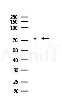 PDE4B/C/D Antibody - Western blot analysis of lysates from Rat lung, using PDE4B/C/D Antibody at 1/1000 dilution.
