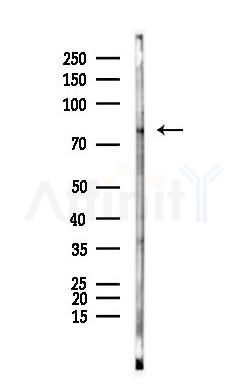 POLR3E Antibody - Western blot analysis of lysates from COLO205 cells(heat-shock 45min treatment), using POLR3E Antibody at 1/1000 dilution.