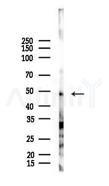TRF1 Antibody - Western blot analysis of lysates from EC304 cells(heat-shock 45min treatment), using TRF1 Antibody at 1/1000 dilution.