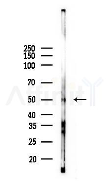 TRF1 Antibody - Western blot analysis of lysates from Mouse brain, using TRF1 Antibody at 1/1000 dilution.