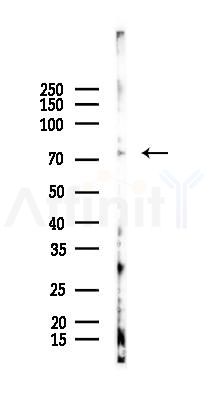 MeCP2 Antibody - Western blot analysis of lysates from EC304 cells(heat-shock 45min treatment), using MeCP2 Antibody at 1/1000 dilution.
