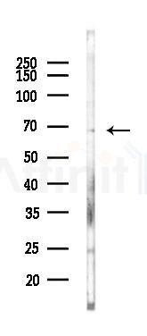 Phospho-NF-kB p65 (Ser536) Recombinant Rabbit mAb - Western blot analysis of lysates from COLO205 cells(heat-shock,45min treatment), using Phospho-NF-kB p65 (Ser536) Recombinant Rabbit mAb at 1/1000 dilution.