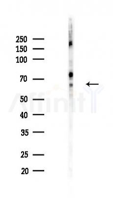 NF-kB p65 Recombinant Rabbit mAb - Western blot analysis of lysates from HUVEC cells(LPS,4h treatment), using NF-KB p65 Recombinant Rabbit mAb at 1/1000 dilution.