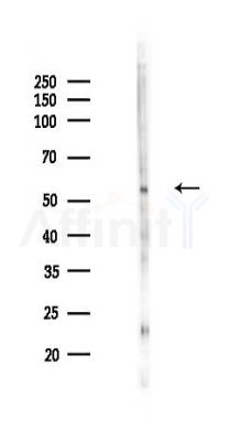 NF-kB p65 Recombinant Rabbit mAb - Western blot analysis of lysates from Rat spleen, using NF-KB p65 Recombinant Rabbit mAb at 1/1000 dilution.