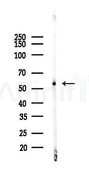 AKT1/2/3 Recombinant Rabbit mAb - Western blot analysis of lysates from Mouse brain, using AKT1/2/3 Recombinant Rabbit mAb at 1/1000 dilution.
