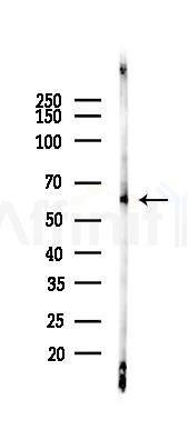 AKT1/2/3 Recombinant Rabbit mAb - Western blot analysis of lysates from Rat heart, using AKT1/2/3 Recombinant Rabbit mAb at 1/1000 dilution.