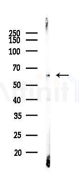 AKT1/2/3 Recombinant Rabbit mAb - Western blot analysis of lysates from COLO205 cells(heat-shock,45min treatment), using AKT1/2/3 Recombinant Rabbit mAb at 1/1000 dilution.