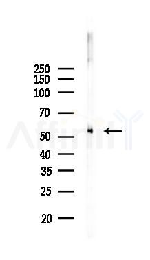 Phospho-AKT1/2/3 (Ser473) Recombinant Rabbit mAb - Western blot analysis of lysates from Mouse brain, using Phospho-AKT1 (Ser473) Recombinant Rabbit mAb at 1/1000 dilution.