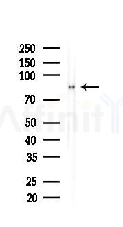 PI3K p85 alpha Recombinant Rabbit mAb - Western blot analysis of lysates from A375 cells(heat-shock,45min treatment), using PI3-Kinase p85 alpha Rabbit mAb at 1/1000 dilution.