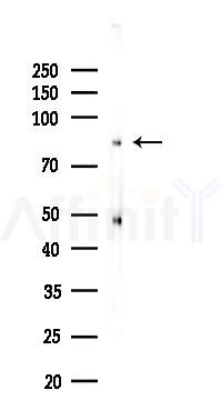 PI3K p85 alpha Recombinant Rabbit mAb - Western blot analysis of lysates from Rat lung, using PI3-Kinase p85 alpha Rabbit mAb at 1/1000 dilution.
