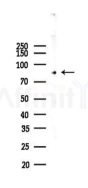 PI3K p85 alpha Recombinant Rabbit mAb - Western blot analysis of lysates from HepG2 cells(heat-shock,45min treatment), using PI3-Kinase p85 alpha Rabbit mAb at 1/1000 dilution.