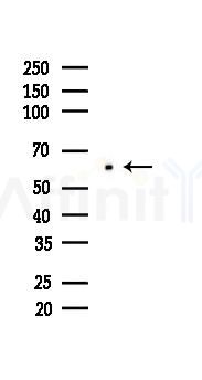 AMPK alpha 1 Recombinant Rabbit mAb - Western blot analysis of lysates from A375 cells(heat-shock,45min treatment), using AMPK alpha 1 Rabbit mAb at 1/1000 dilution.