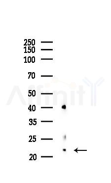 Bax Recombinant Rabbit mAb - Western blot analysis of lysates from PC12 cells(LPS, 4h treatment), using Bax Recombinant Rabbit mAb at 1/1000 dilution.