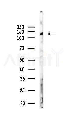iNOS Recombinant Rabbit mAb - Western blot analysis of lysates from RAW264.