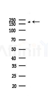 MRC1/CD206 Recombinant Rabbit mAb - Western blot analysis of lysates from HepG2 cells(heat-shock,45min treatment), using Mannose Receptor Rabbit mAb at 1/1000 dilution.