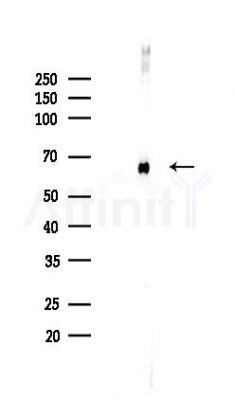 SQSTM1/p62 Recombinant Rabbit mAb - Western blot analysis of lysates from HUVEC cells(LPS,4h treatment), using SQSTM1/p62 Recombinant Rabbit mAb at 1/1000 dilution.
