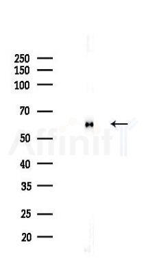 SQSTM1/p62 Recombinant Rabbit mAb - Western blot analysis of lysates from HepG2 cells(starvation,24h treatment), using SQSTM1/p62 Recombinant Rabbit mAb at 1/1000 dilution.