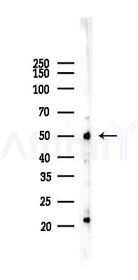 TGF beta 1 Recombinant Rabbit mAb - Western blot analysis of lysates from HepG2 cells(heat-shock,45min treatment), using TGF beta 1 Rabbit mAb at 1/1000 dilution.